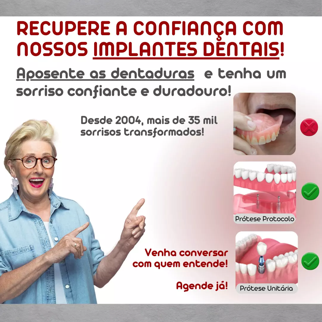 IMPLANTES DENTÁRIOS - PRÓTESES